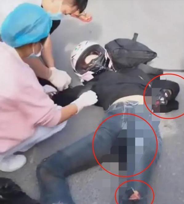 身亡现场惨状细节曝光就喜欢穿飙车！千亿球友会首页19岁机车女网红车祸(图3)